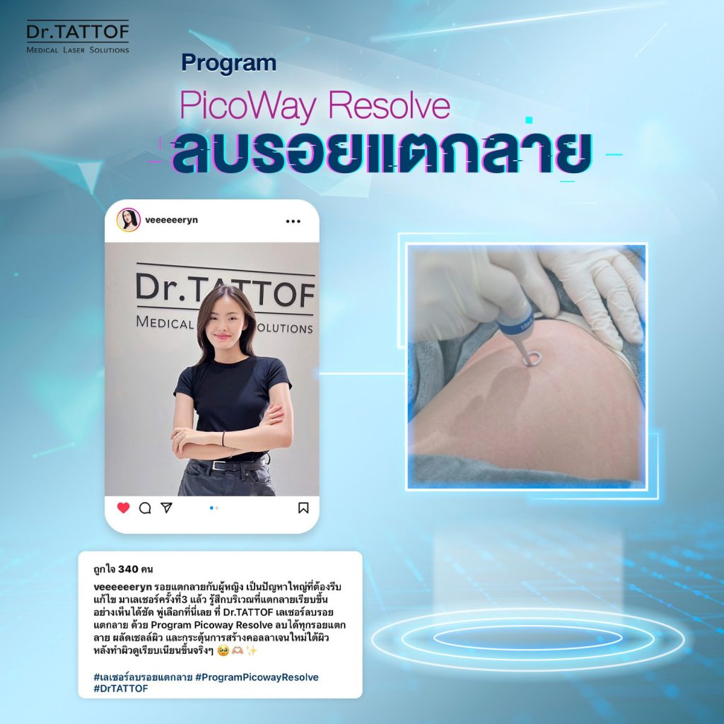 ลบรอยแตกลาย