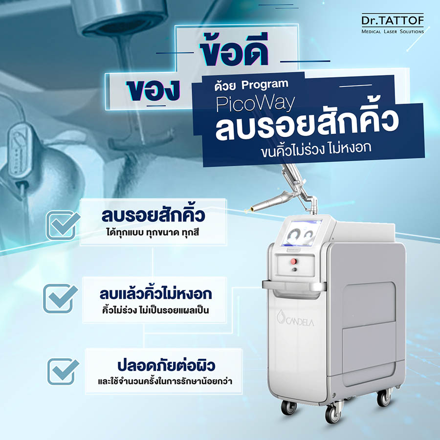ลบรอยสักคิ้ว ด้วยโปรแกรม PicoWay Laser ตัวช่วยเปลี่ยนคิ้วพังเป็นคิ้วปั