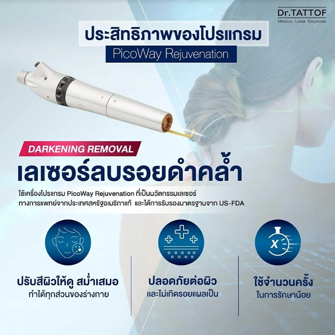 รักแร้ดำ PicoWay laser