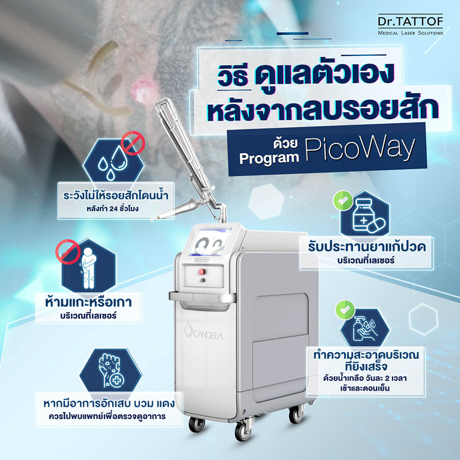 ดูแลผิวหลังลบรอยสัก